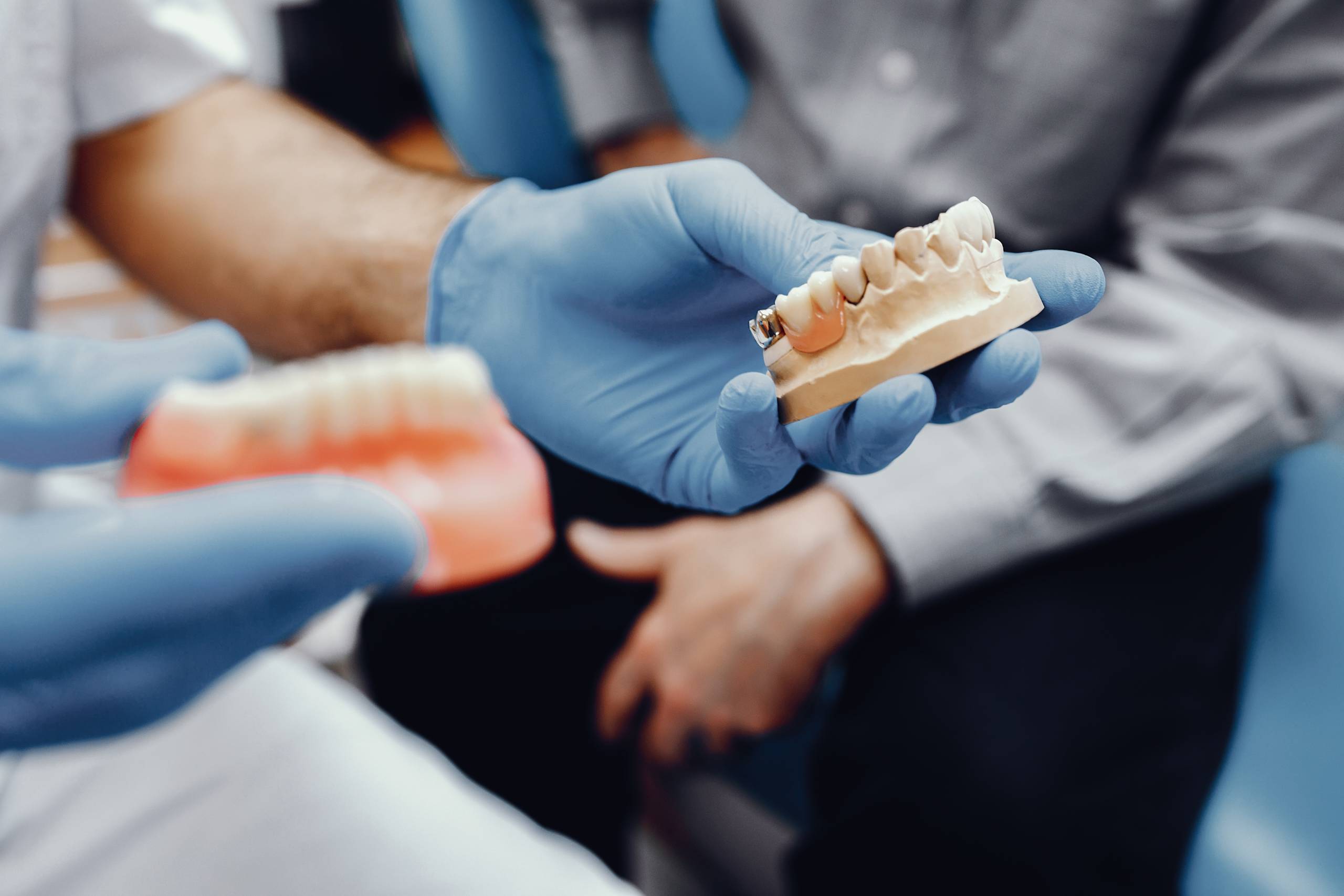 Dental İmplant